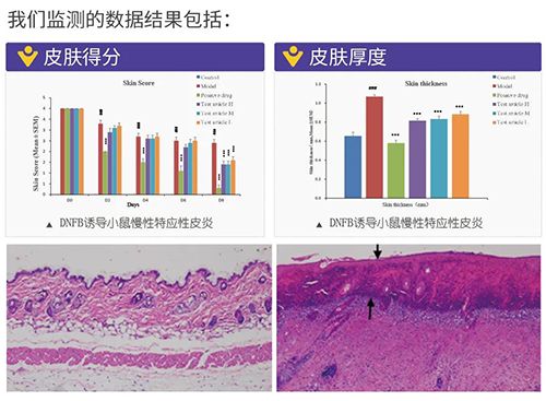 ag亚娱建立的特应性皮炎及湿疹模型监测数据结果