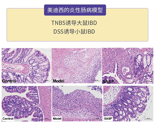 ag亚娱的炎症性肠病模型