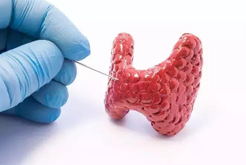 甲状腺疾病，包括甲状腺功能减退和甲状腺功能亢进，自古以来就是反复被医学研究人员研究的疾病