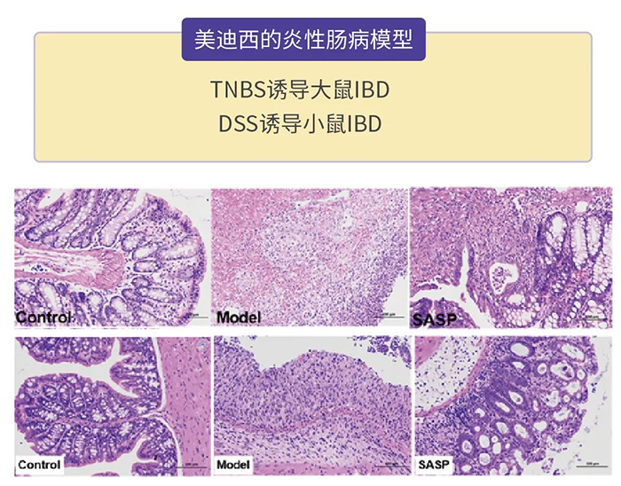 ag亚娱的炎性肠病模型.png ag亚娱的炎性肠病模型.png